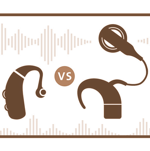ผ่าตัด ประสาท หู เทียม ประสาทหูหนวก ประสาทหูเทียมเหมือนเครื่องช่วยฟังหรือไม่