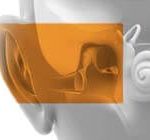 อาการ หูตึง หูหนวก การสูญเสียการได้ยินที่เกิดจากการนำเสียงบกพร่อง