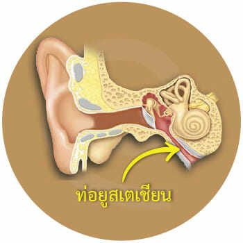 7 สาเหตุที่ทำให้เกิดอาการ เสียงในหู - ศูนย์บริการ เครื่องช่วยฟัง อินทิเม็กซ์