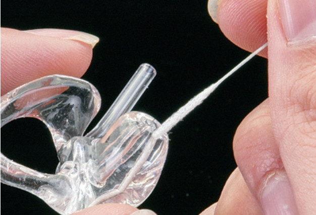 พิมพ์หู เครื่องช่วยฟัง Eamolud Hearingaid มีปัญหา Vents