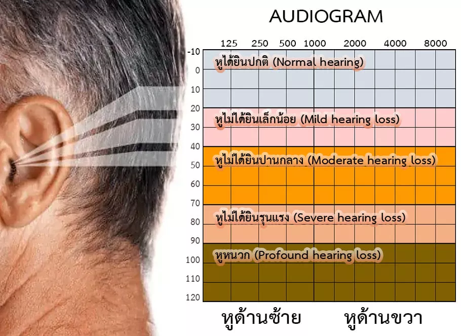 hearing loss