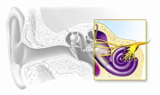 ประเภทประสาทรับเสียงบกพร่อง (Sensorineural hearing loss)