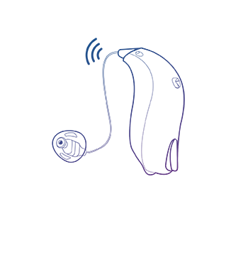 เครื่องช่วยฟัง Alpha ป้องกันเสียงหวีด